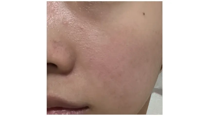 로터스 트러블 케어 패드 미니 상세 이미지 20